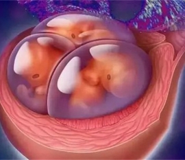 婴儿腹泻应该怎么办？